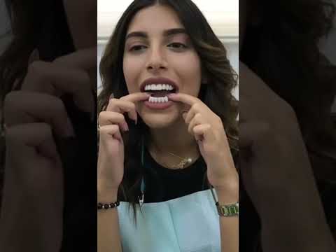 أسنان صناعية من السيليكون لابتسامة مثالية و دون عيوب متوفرة الجزائر الجزائر اليوم الجزائري وهران