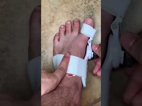 مصحح الاصابع وتقويم العظام Shorts