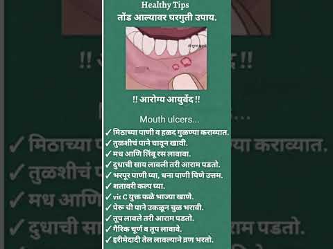 त ड आल य वर घरग त उप य Mouth Ulcers Shorts Ytshorts Shortsfeed Healthtip Mouthulcers Viral