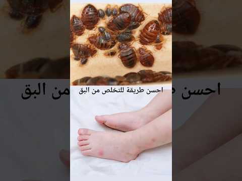 احسن طريقة للتخلص من بق الفراش بمكونات بسيطة