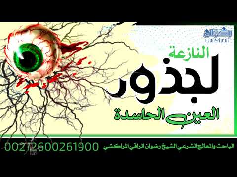 النازعة لجذور العين الحاسدة بإذن الله النازعة لجذور العين الحاسدة بإذن الله