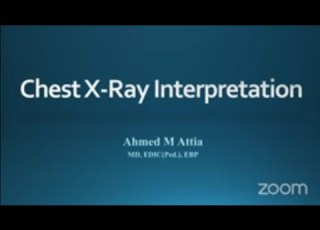  Chest X Ray Interpretation For Young Pediatrician Part 1 Dr Ahmed Attia