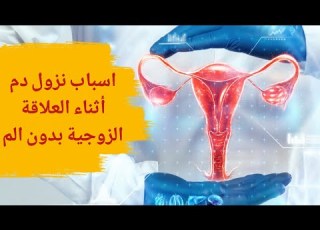  أسباب نزول دم أثناء العلاقة الزوجية بدون ألم ما سبب نزول الدم عند ممارسة العلاقة الزوجية