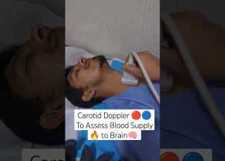  Carotid Doppler Scan To Assess Blood Supply To Brain Ytshorts Viral Scan Health Radiology
