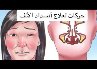 حركات لعلاج أنسداد الأنف