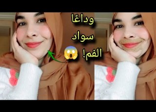  تفتيح منطقة الفم في أيام فقط وصفة سهلة أسباب السواد لي خاصك تعرفيها