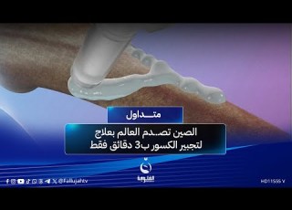 الصين تصــ دم العالم بعلاج لتجبير الور ب3 دقائق فقط متداول
