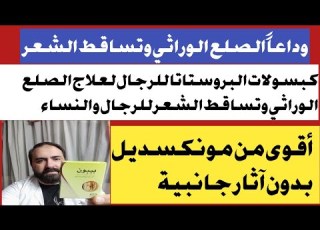 مفاجاه 2025 كبسول البروستاتا للرجال لعلاج الصلع الوراثي الثعلبه وتساقط الشعر للرجال والنساء