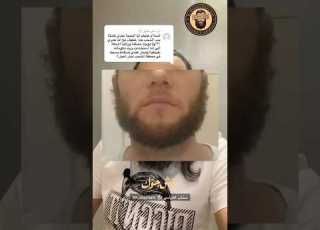  انا اللحية عندي كاملة بس الشنب خفيف والموضوع غير وراثي واستخدمت زيت سببلي تساقط ايش الحل