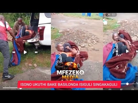 Usamangele Namanje Ovele Wagixabezwa Ngesiguli Esingakwazi Ukuhamba Ukhuluma Sixoshwa Umndeni Waso