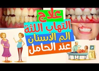  علاج التهاب اللثة عند الحامل و الم الاسنان عند الحامل
