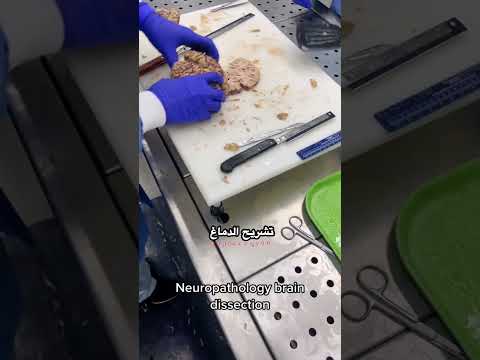 تشريح اكسبلور جنائية ترند تيك توك لايك متابعه دويتو جامعة Newvideo تشريح اكسبلور جنائية ترند تيك توك لايك متابعه دويتو جامعة Newvideo