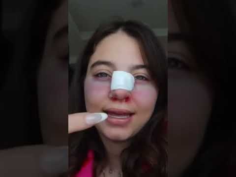 بيسان اسماعيل عملت عملية تجميل