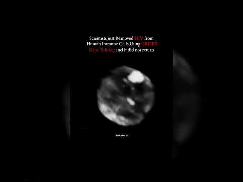 This Could Be The End Of HIV CRISPR Breakthrough Shocks Scientists