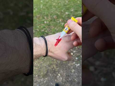 Wunde Mit Sekundenkleber Verschließen Gutzuwissen Survivalhack Notfall Wunde Diy Kleber