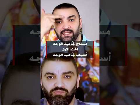 علاج تجاعيد الوجه والجبهة والعينين تجاعيد التجاعيد البشرة محمد سويلم