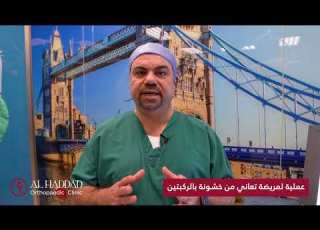 خشونة الركبتين عملية على يد الطبيب وائل حداد