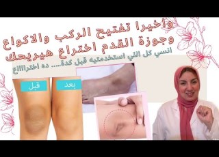 The Cheapest Formula To Lighten The Knees And Elbows This Is An Invention