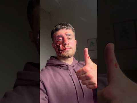 رسمت على وجهي جرح وفاجأت الناس