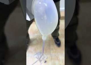 رجل كبير تتبول عل نفسك طريقة استعمال كيس التبول