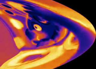  Zoopals In Invert Deformation Slow 4x Thermal