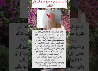 ماسبب ظهور بقع بيضاء على الظفر Shorts علم النفس معلومات طبيه