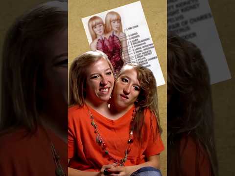 زواج التوأم الملتصق الأكثر غرابه فى العالم