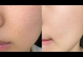 Experimental Textureless Baby Skin ୨୧ Deep Exfoliation 1X