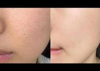 Experimental Textureless Baby Skin ୨୧ Deep Exfoliation