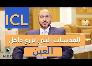  العدسات التي ت زرع داخل العين ICL الدكتور أحمد المعتصم