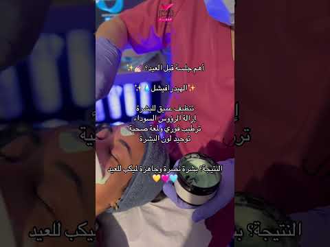 استعدي للعيد ببشرة نضرة بعد الهيدرافيشل احجزي جلستك الآن عيد اجراءات عيادات بيرل الازدهار استعدي للعيد ببشرة نضرة بعد الهيدرافيشل احجزي جلستك الآن عيد اجراءات عيادات بيرل الازدهار