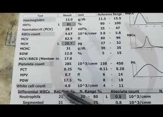 قراءة تحليل صورة الدم أو Complete Blood Count CBC هو واحد من أكثر التحاليل الطبية شيوعا