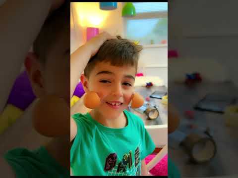 خلودة عم يقلد المجانين