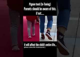 Pigeon Toed Walking In Toeing Baby Walking Parents Should Be Aware Of Shorts