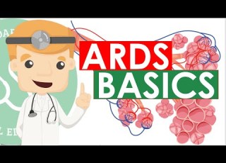  Acute Respiratory Distress Syndrome ARDS Basics Clinical Medicine