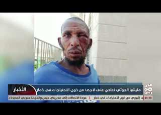  عناصر حوثية يعتدون على مقيم من الية الإثيوبية في ذمار