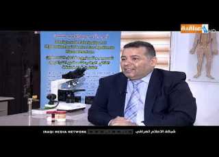 براءة اختراع مع رسول الزبون