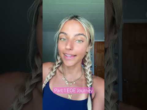 Finding Out I Have EOE Eoe Glutenfree Wheatfree Dairyfree Foodallergy Allergylife