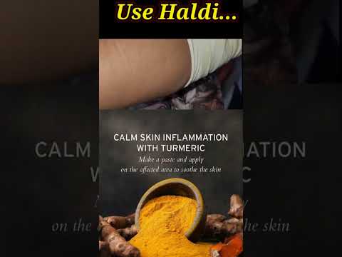 Home Remedies To Cure Wound Pain Instant Wound Pain Healing Youtube Shorts