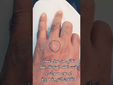 اذا كنت تعاني من عرق النساء اليك الحل بدون جراحة