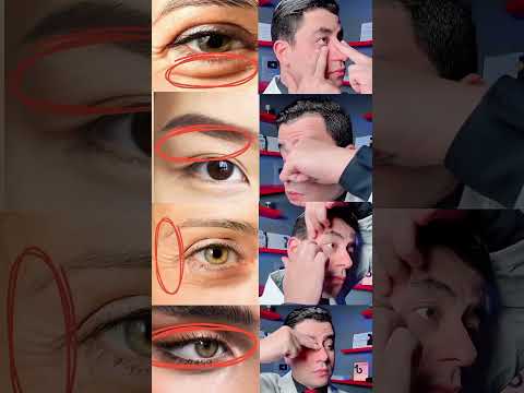 تمارين هتحل كل مشاكل العين