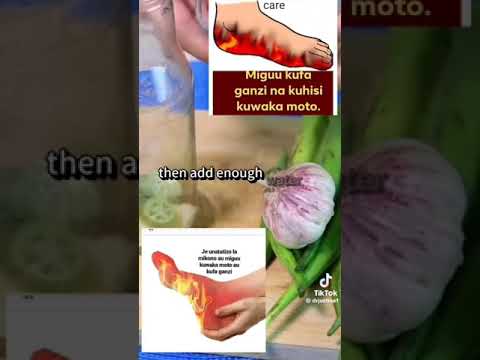 NJIA RAHISI YA KUONDOA GANZI KWENYE MWILI NA MIGUU KUWAKA MOTO TUMIA MCHANGANYIKO HUU