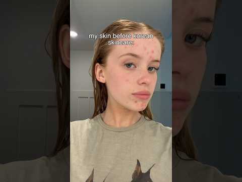 I Tried A Korean Skincare Routine For 3 Weeks Heres The Results So Far See Description I Tried A Korean Skincare Routine For 3 Weeks Heres The Results So Far See Description