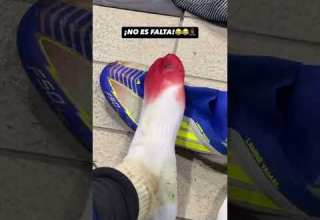 Lamineyamal Injury Barcelona Las Palmas لاعب لاس بالماس غرز حذاءه ب لامين يامال برشلونة