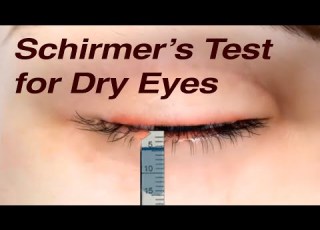  Schirmer S Test For Dry Eyes