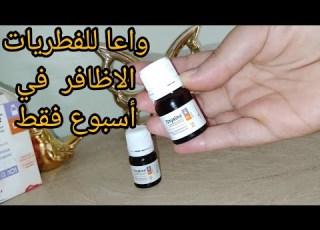 اول مرة على اليوتيوب أقوى علاج للفطريات الاظافر قضاء عليها بصفة نهائيا عن تجربتي شخصية