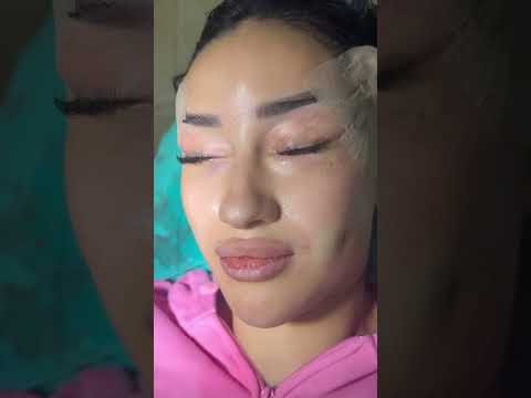 Cateyes عملية سحب الجفون عيون القطه تجميل تجميلية بشرة العراق المغرب Cateyes عملية سحب الجفون عيون القطه تجميل تجميلية بشرة العراق المغرب