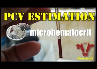  Micro Hematocrit PCV Packed Cell Volume Hematocrit Microhematocrit Pcv Capillarymethod