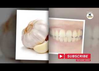 Ugonjwa Wa Fungus Mdomoni Dalili Na Tiba Yake