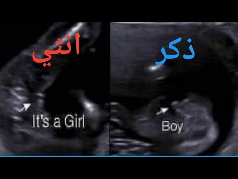 معرفة نوع الجنين فى الشهر الثالث الحمل والجنين فى الشهر الثالث